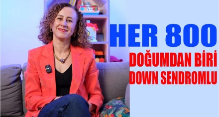 Her 800 doğumdan biri Down sendromlu